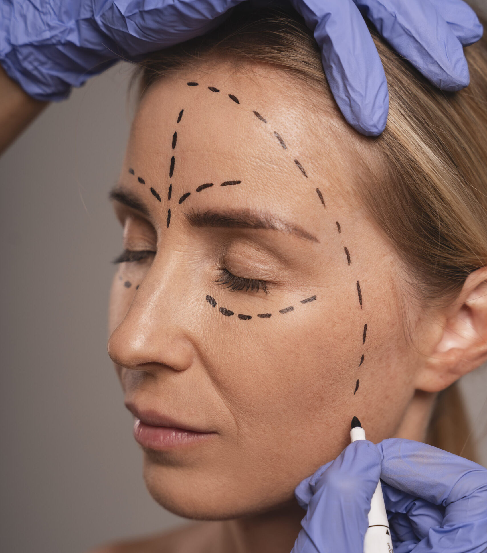woman preparing cosmetic surgery